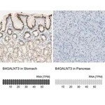 Merck Anti-B4GALNT3 antibody produced in rabbit