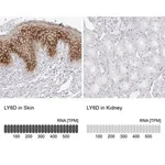 Merck Anti-LY6D antibody produced in rabbit