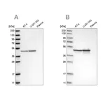 Merck Anti-FH antibody produced in rabbit