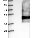 Merck Anti-SSTR2 antibody produced in rabbit