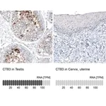 Merck Monoclonal Anti-CT83 antibody produced in mouse