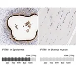 Merck Anti-IFITM1 antibody produced in rabbit