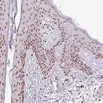 Merck Anti-RARG antibody produced in rabbit