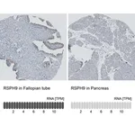 Merck Anti-RSPH9 antibody produced in rabbit
