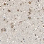 Merck Anti-ACSL4 antibody produced in rabbit