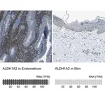 Merck Anti-ALDH1A2 antibody produced in rabbit