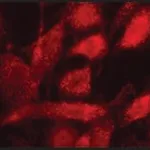 Merck Anti-PMP70 antibody produced in rabbit