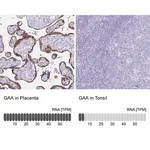 Merck Anti-GAA antibody produced in rabbit