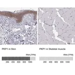 Merck Anti-PKP1 antibody produced in rabbit