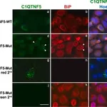 Merck Anti-GRP78/BiP (GL-19) antibody produced in rabbit