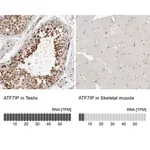Merck Anti-ATF7IP antibody produced in rabbit