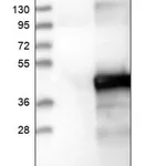 Merck Anti-ETV7 antibody produced in rabbit