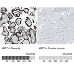 Merck Anti-KRT7 antibody produced in rabbit
