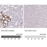 Merck Anti-SLC12A3 antibody produced in rabbit