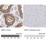 Merck Anti-G6PD antibody produced in rabbit