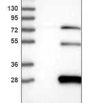 Merck Anti-TASP1 antibody produced in rabbit