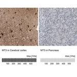 Merck Anti-MT3 antibody produced in rabbit