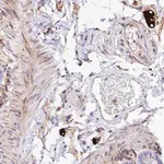 Merck Anti-TRPV2 antibody produced in rabbit