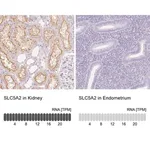 Merck Anti-SLC5A2 antibody produced in rabbit