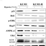 Merck Anti-ULK1 antibody produced in rabbit