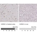 Merck Anti-CARNS1 antibody produced in rabbit