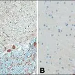 Merck Anti-Myosin Va (LF-18) antibody produced in rabbit