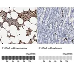 Merck Anti-S100A8 antibody produced in rabbit