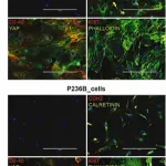 Merck Anti-CALB2 antibody produced in rabbit