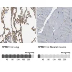 Merck Anti-SPTBN1 antibody produced in rabbit