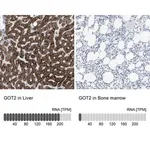Merck Anti-GOT2 antibody produced in rabbit