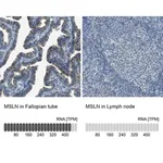 Merck Anti-MSLN antibody produced in rabbit