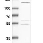 Merck Anti-ALPK1 antibody produced in rabbit
