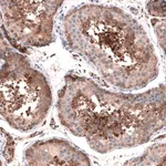 Merck Anti-OSBP2 antibody produced in rabbit