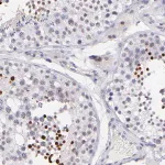 Merck Anti-SOX6 antibody produced in rabbit