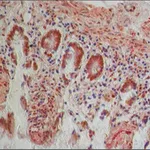 Merck Anti-PKM2 (isoform M1) antibody produced in rabbit