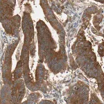 Merck Anti-ROCK2 antibody produced in rabbit