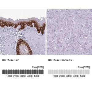 Merck Anti-KRT5 antibody produced in rabbit