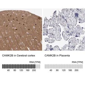 Merck Anti-CAMK2B antibody produced in rabbit