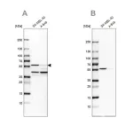 Merck Anti-PHGDH antibody produced in rabbit