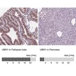 Merck Anti-UBN1 antibody produced in rabbit