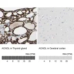 Merck Anti-ACADL antibody produced in rabbit