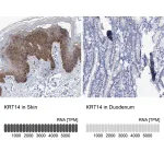 Merck Anti-KRT14 antibody produced in rabbit