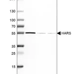 Merck Anti-HARS antibody produced in rabbit