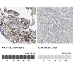 Merck Anti-KIAA1462 antibody produced in rabbit