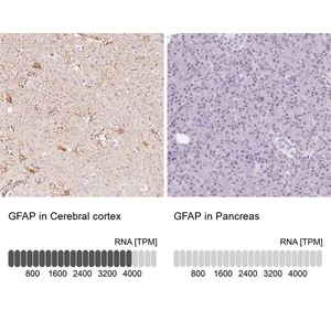 Merck Anti-GFAP antibody produced in rabbit