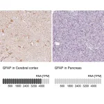 Merck Anti-GFAP antibody produced in rabbit