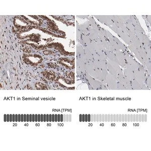 Merck Anti-AKT1 antibody produced in rabbit