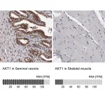 Merck Anti-AKT1 antibody produced in rabbit
