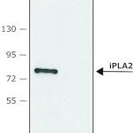 Merck Anti-Phospholipase A2 (iPLA2) (C-terminal region) antibody produced in rabbit