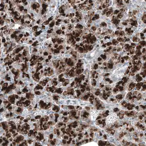 Merck ANTI-DHRSX antibody produced in rabbit